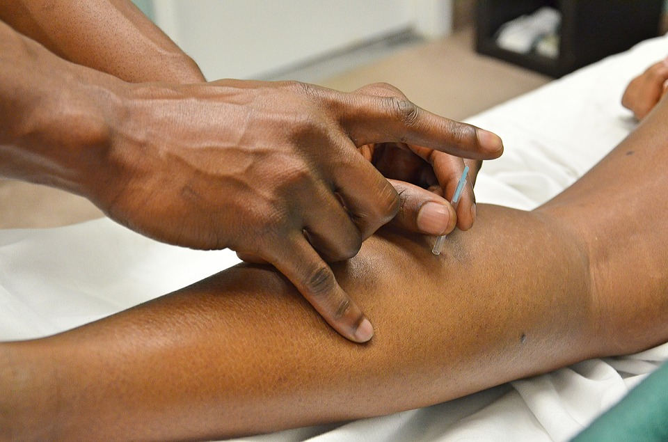 acupuncture-2277444_960_720